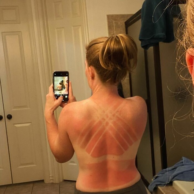 6698d85befee5_funny-sunburn-tan-lines-fails