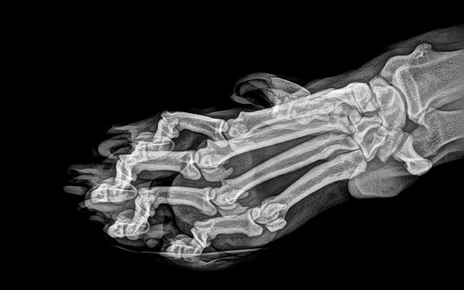 xray-pictures-photos-zoo-animals-oregon-oregonzoo