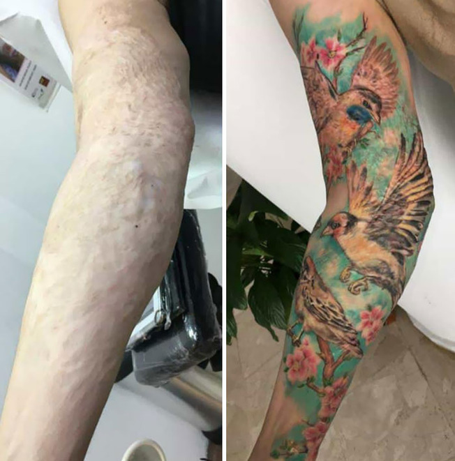 scar-birthmark-cover-up-tattoos-11-6130e311bb471__700