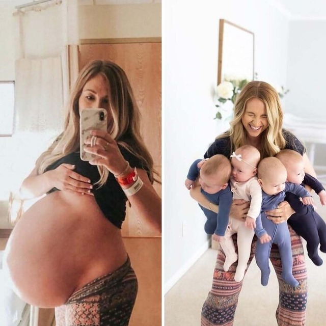 68a434fc15fa1_fascinating-images-of-the-human-body__700