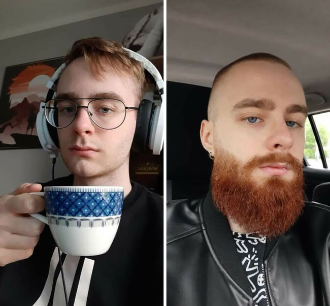 before-after-beard-growing-pics-10-64367a3ba9f98__700