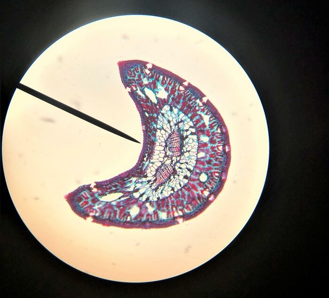 68495e425c584_interesting-microscope-pictures