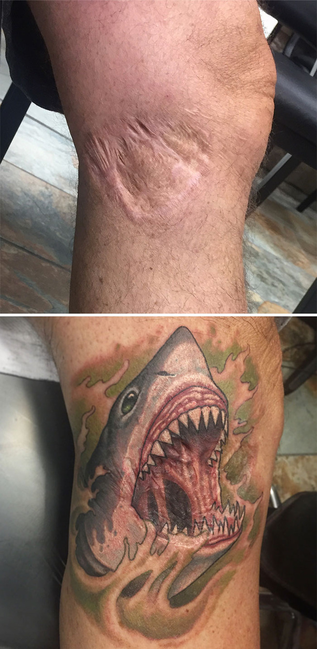 scar-birthmark-tattoo-cover-ups-110-5c0945a67dc54__700 (1)