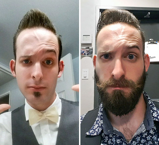 before-after-beard-growing-pics-72-64521acd87d10__700