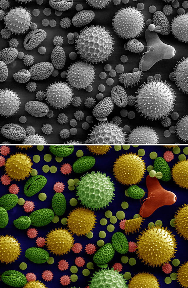 interesting-microscope-pictures-8-68493e2f40de1__700