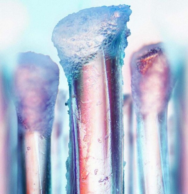 6848259e043ab_interesting-microscope-pictures