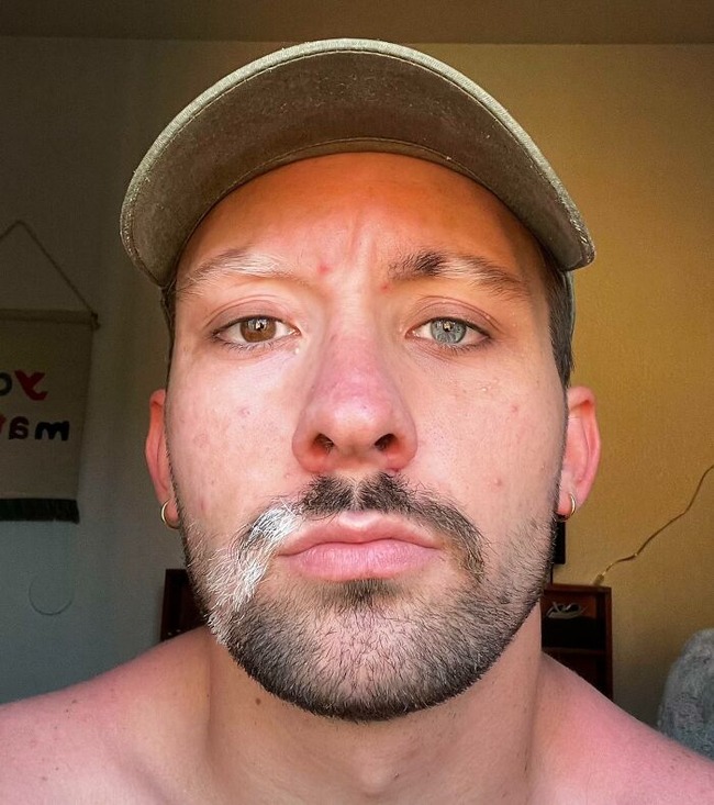 654a5e39eeb85_rare-genetics-unique-people