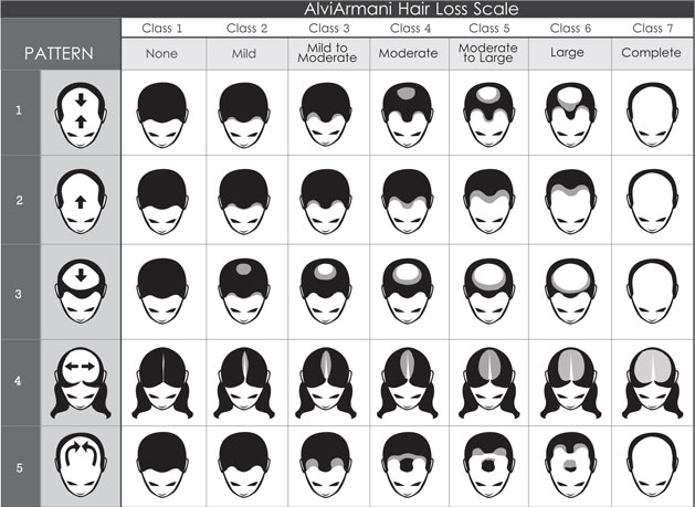alvi-armani-hair-loss-scale