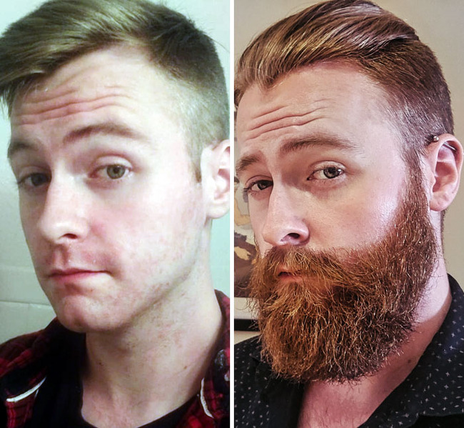 before-after-beard-growing-pics-35-645115d195523__700