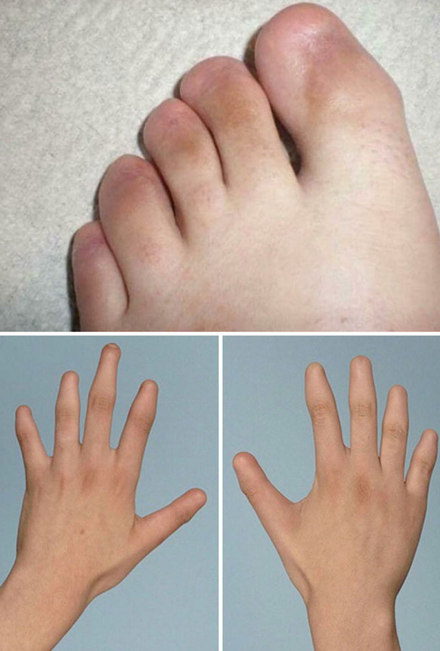 human-body-2-68a435dc00111__700