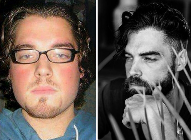 before-after-beard-growing-pics-2-64492a89cf2aa__700