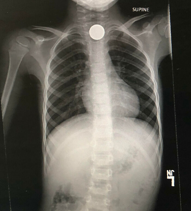 69679564321ca_expensive-mistakes