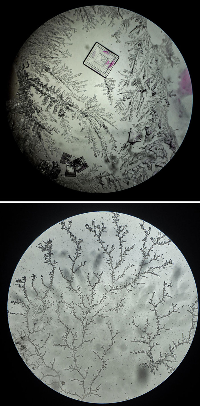 interesting-microscope-pictures-14-684989287f856__700