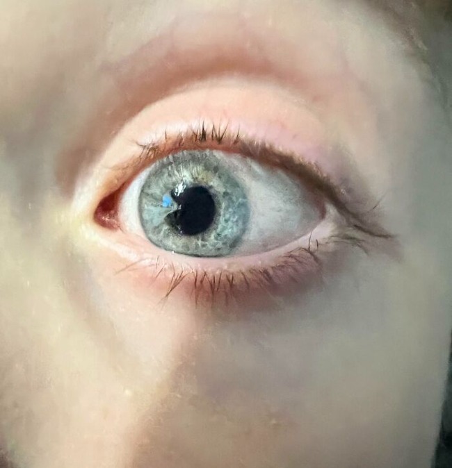 6551f3e34ac54_rare-genetics-unique-people
