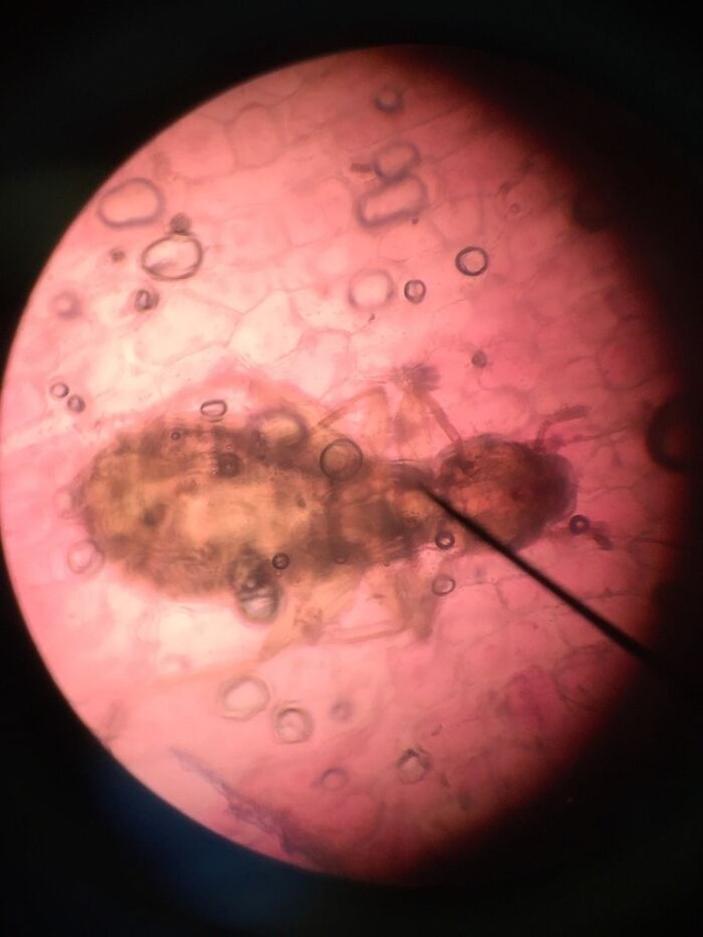 684967cbdca26_interesting-microscope-pictures