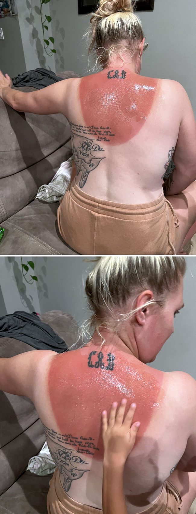 funny-sunburn-tan-lines-fails-2-6690bc4d29a87__700