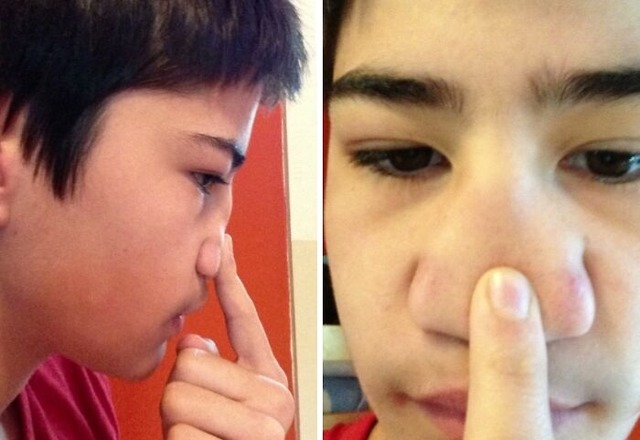 68a436736d3c0_fascinating-images-of-the-human-body__700