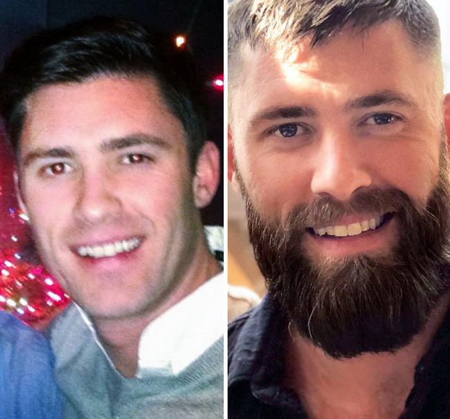 before-after-beard-growing-pics-20-644a7dfa463f0__700