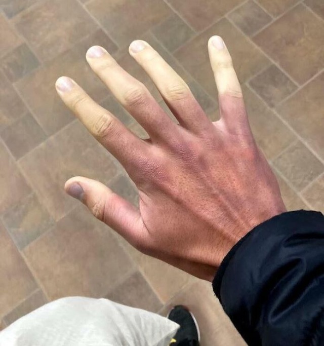 68a431eb751d1_fascinating-images-of-the-human-body__700