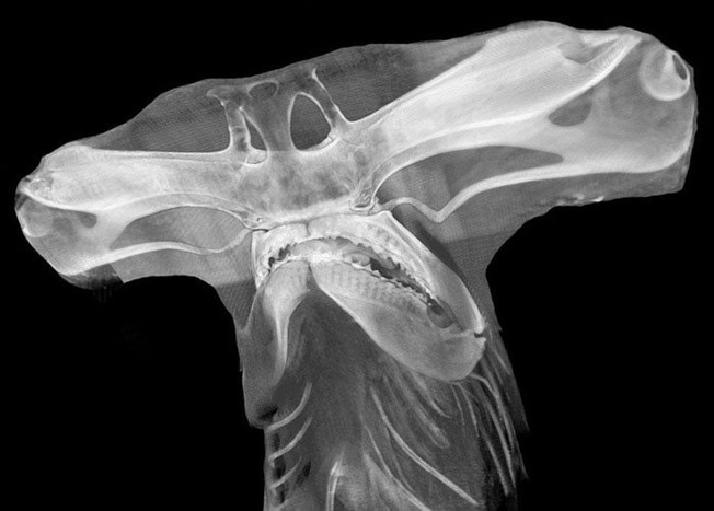 weird-interesting-funny-x-ray-pictures-2-5f58d83b51f6f__700