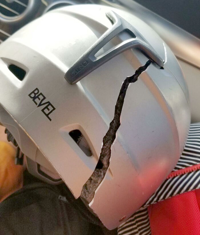 examples-wearing-helmet-is-important-7-62da64bfdcf64__700