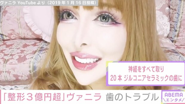 ヴァニラ、整形費用3億円超で手に入れた小顔美が輝く「七五三」スタイルを披露！