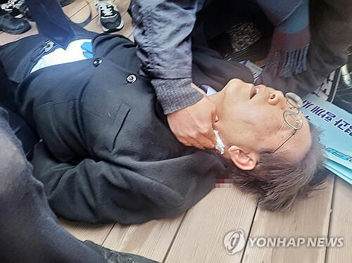 韓国野党代表の刺され事件、医師団体が業務妨害で告発！ネットの反応は？