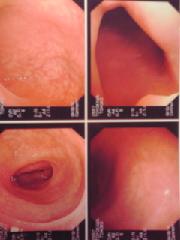 R15(ウソ) 穴の中見せます。