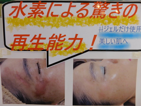 DSCN9874