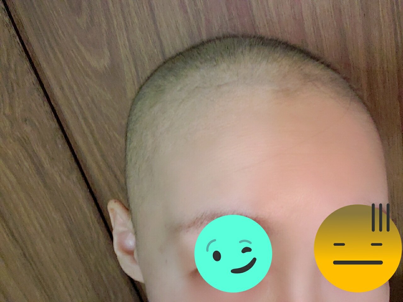 放射線治療終了 とりあえず全ての治療が一旦終わりました もう一人の私 Hiv感染 乳がん 脳動脈瘤患者として