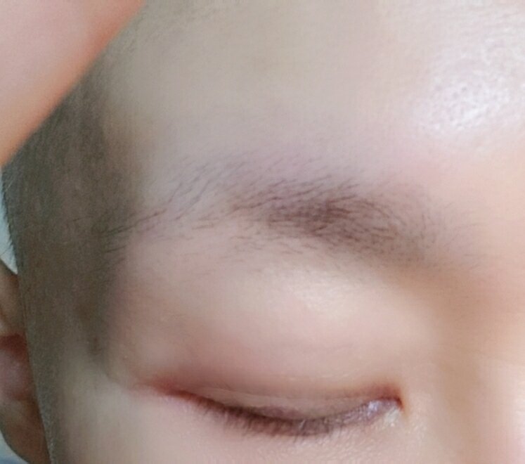 放射線治療終了 とりあえず全ての治療が一旦終わりました もう一人の私 Hiv感染 乳がん 脳動脈瘤患者として