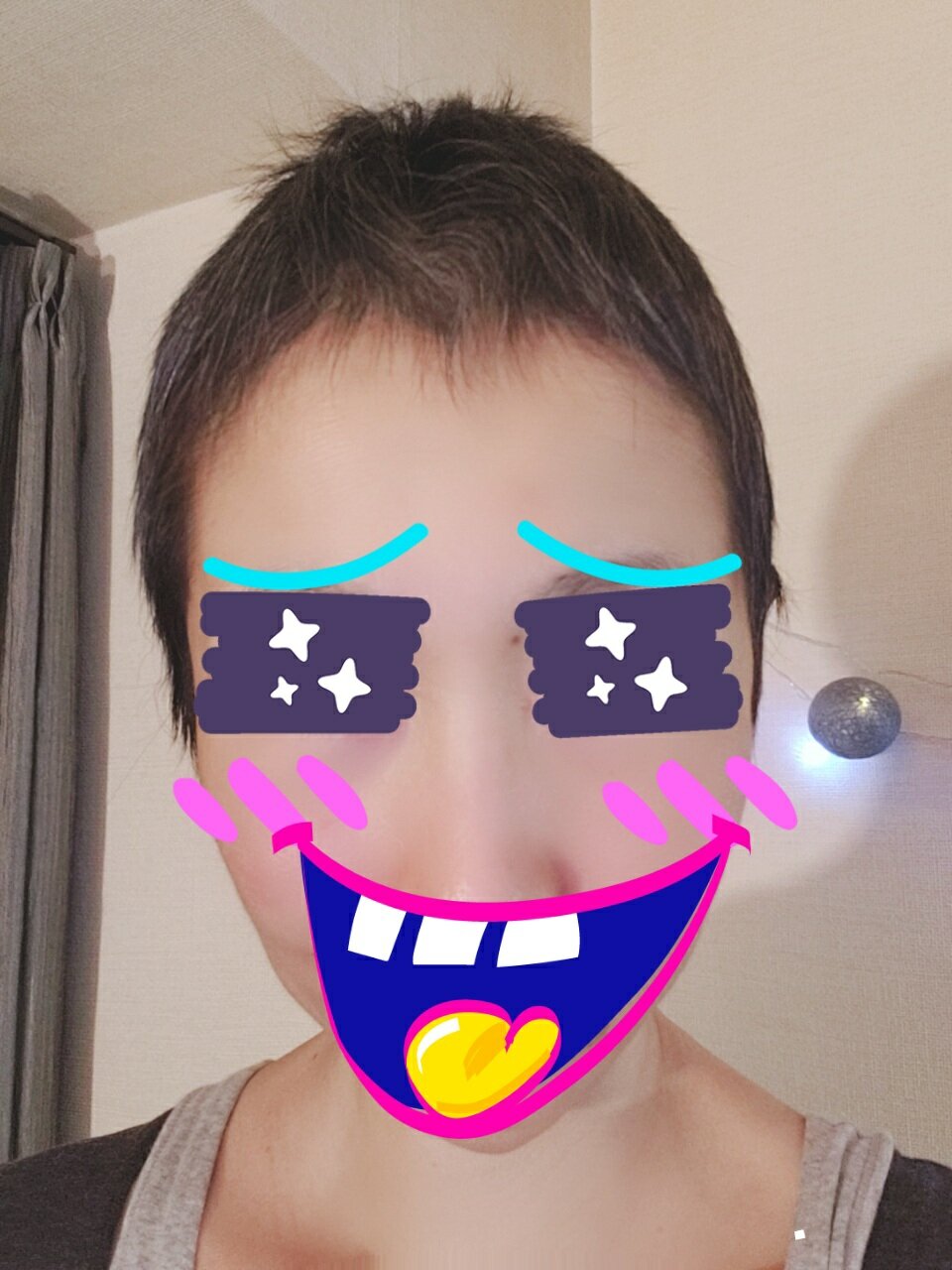 乳がん発覚してからちょうど1年が経ちました もう一人の私 Hiv感染 乳がん 脳動脈瘤患者として
