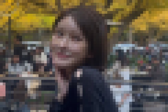 【画像】女さん、顔の脂肪除去した結果　→とんでもないことに