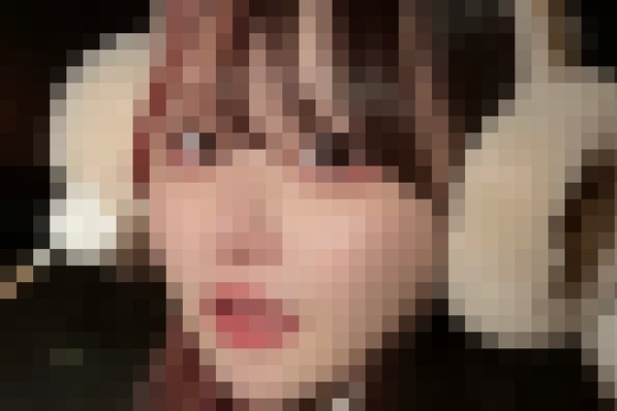 【画像】整形アイドル轟ちゃん（32）「整形してるから老化早い」の声に7年前とのビフォアフ公開「若返ってる」「どんどん綺麗になる」と反響