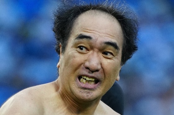 【悲報】江頭2:50さん、心の病を公表