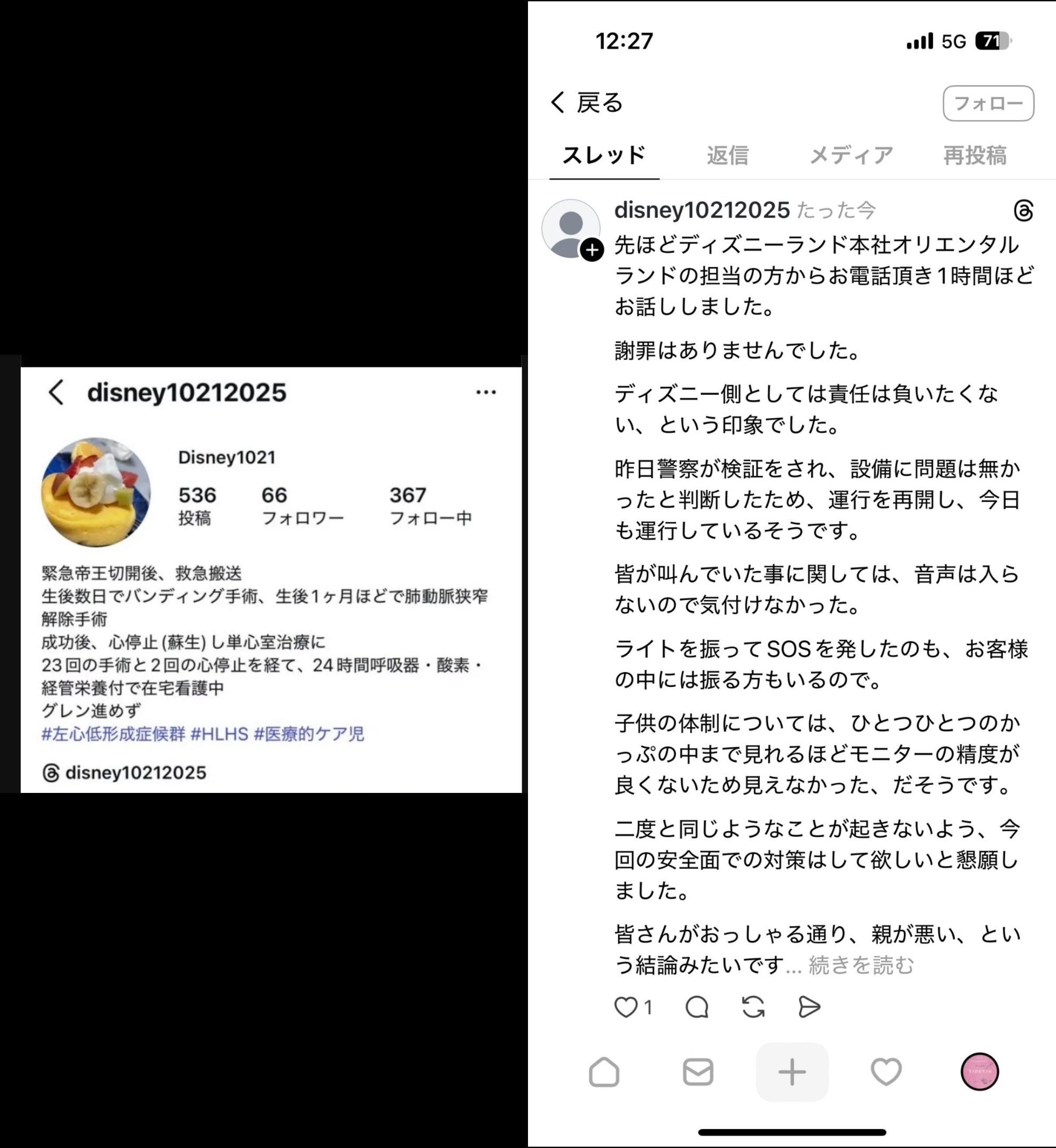 画像 オリエンタルランド ものがたり けが 野獣に関連した画像-01