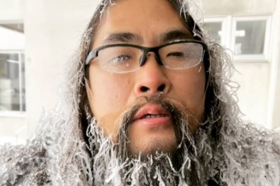 【悲報】ロッチ・中岡、『イッテQ』のロケ中に骨折してしまう
