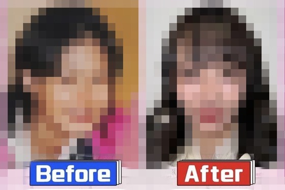 【画像】現代の整形、ここまで綺麗になる