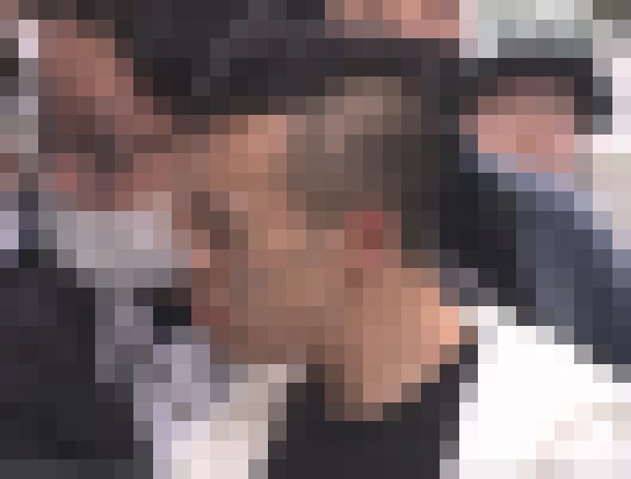 【画像】町田で人を刺したナイフ男、29歳なのに頭皮がだいぶヤバい