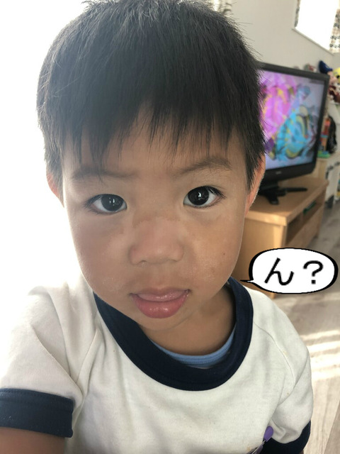 季節外れの日焼けで真っ黒こげに。