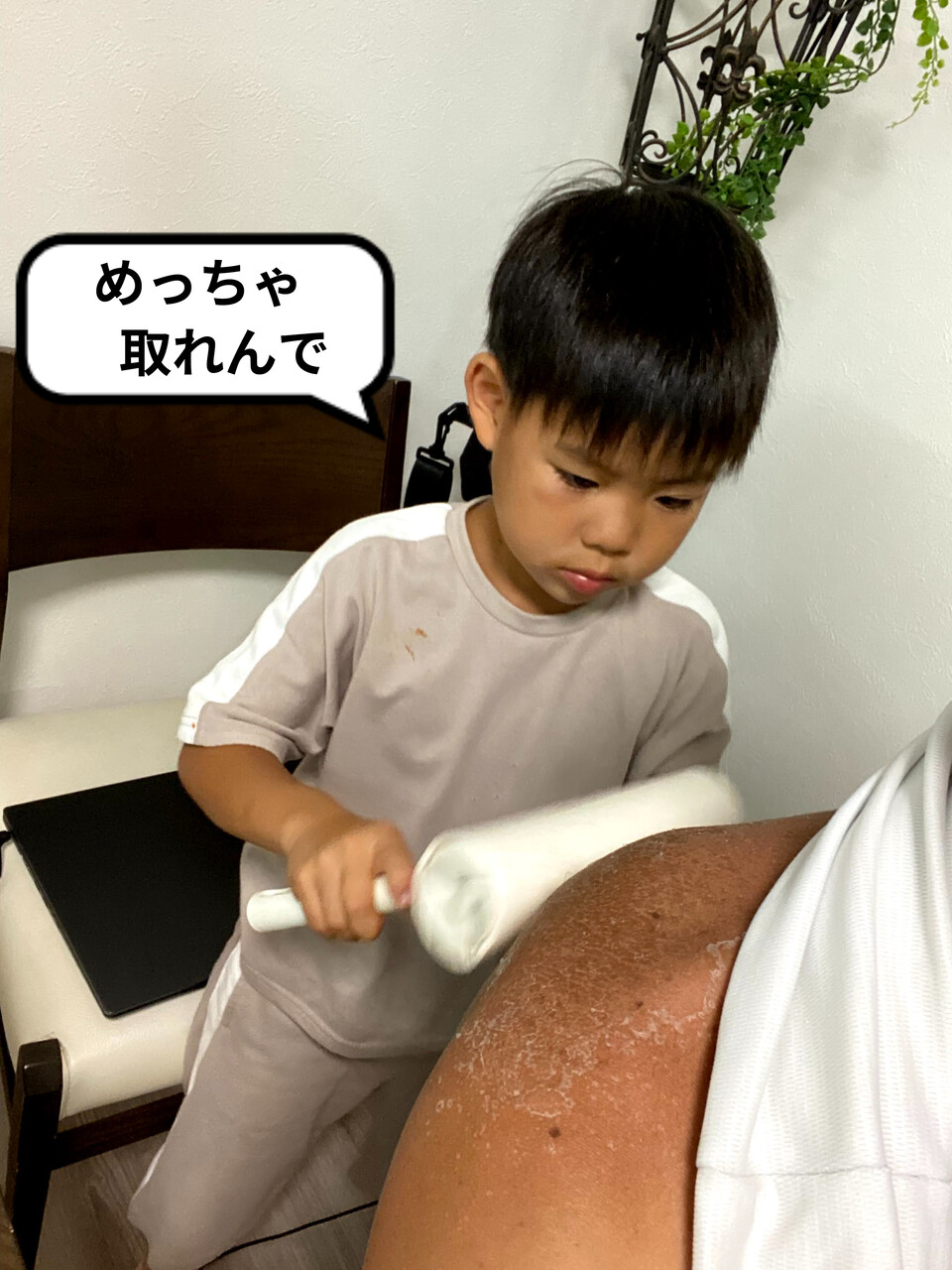 日焼けした皮をキレイに剥く方法 とおちゃんと はっちゃん