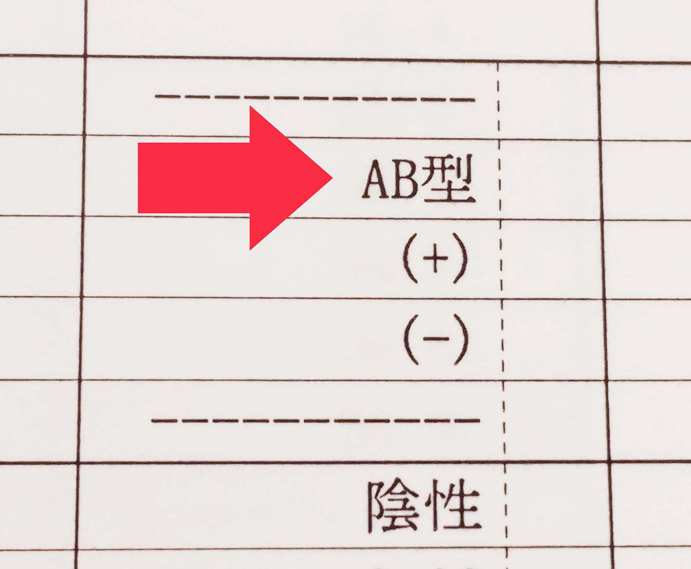 型 検査 血液 血液型検査