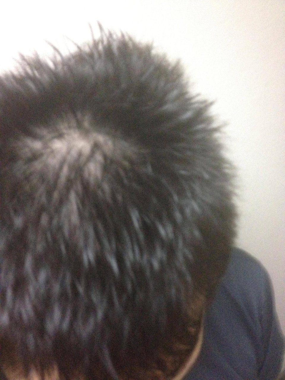 全スカだからニット帽以外選択肢ないんだが夏どうすりゃいいんだｗ 脱aga 発毛情報まとめヽ W ﾉ