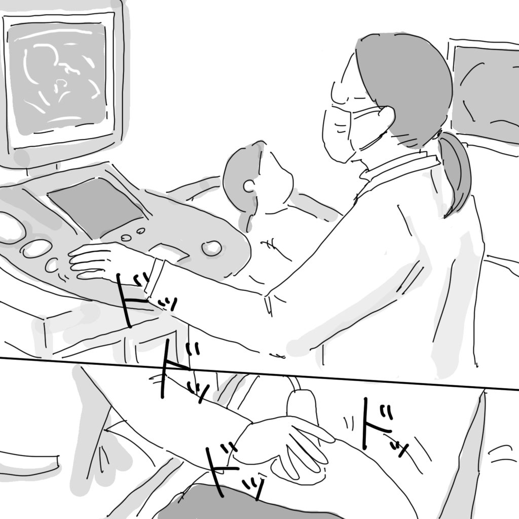 エコー検査の様子