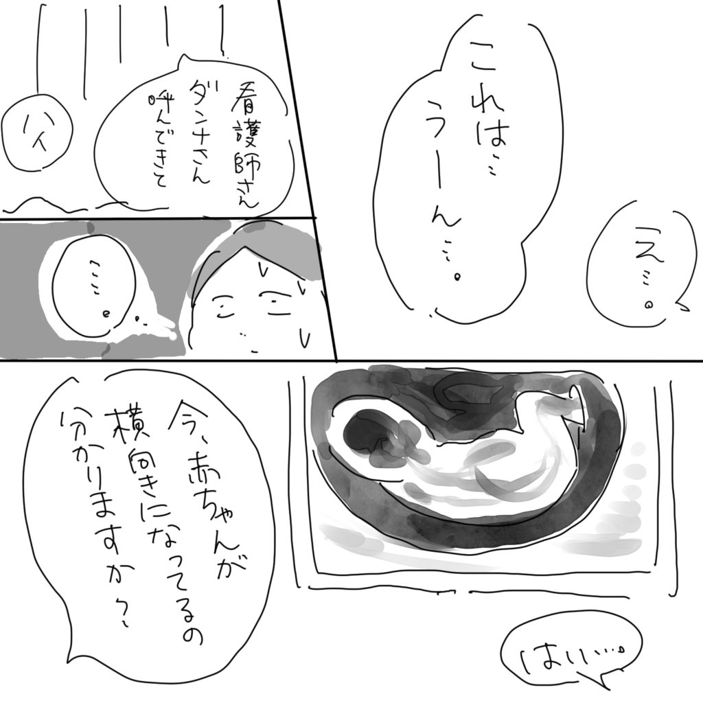 「え…。」「これは…うーん…。」「看護師さんダンナさん呼んできて」「ハイ」「…。」「今、赤ちゃんが横向きになってるの分かりますか？」「はい…。」