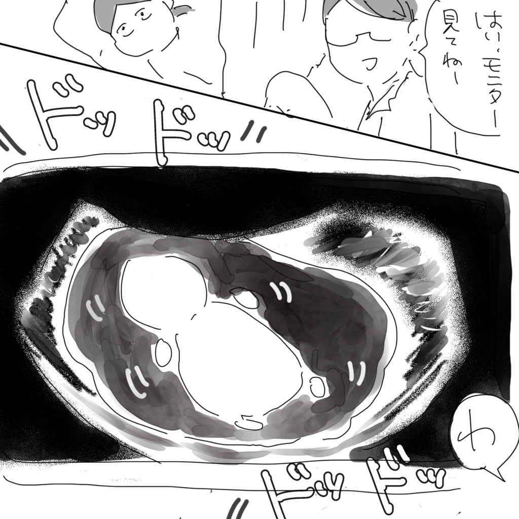 「はい、モニター見てねー」「わ」