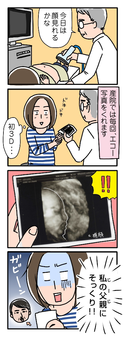 姉ちゃんは育児中-3Dエコー