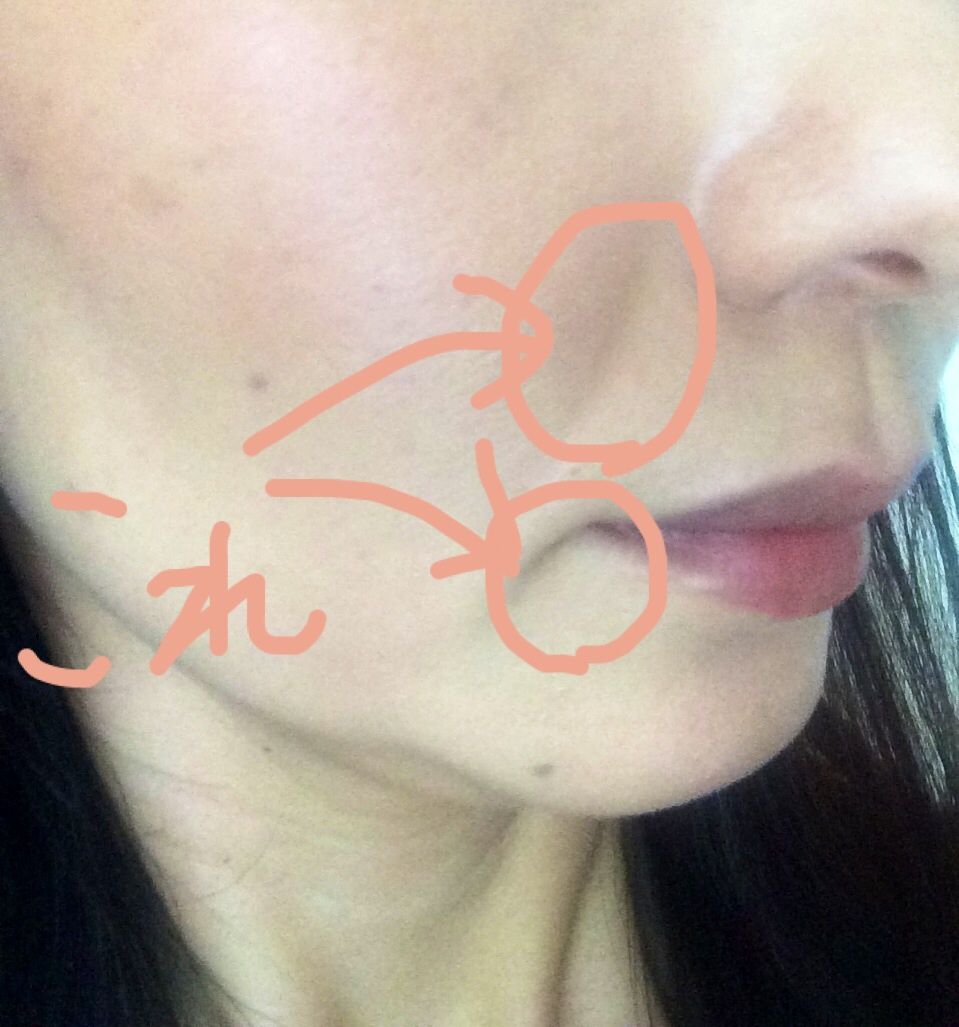 Facial Fitness Pao パオ で素敵な笑顔に Vo 1 あんじゅの居場所