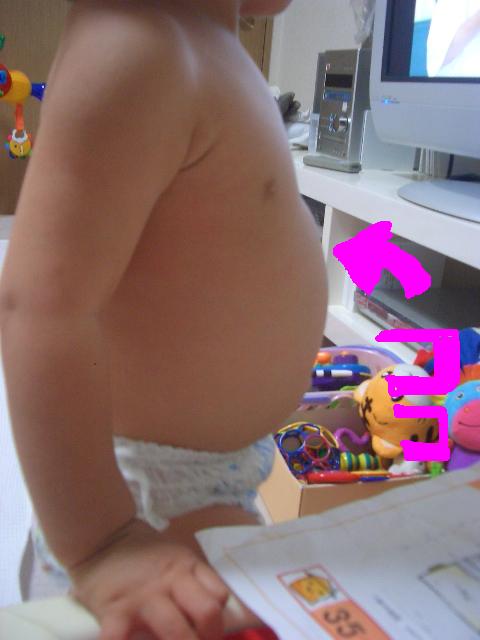 子どもの腹痛 小平市の湯川医院 内科 小児科 アレルギー科 リウマチ 膠原病