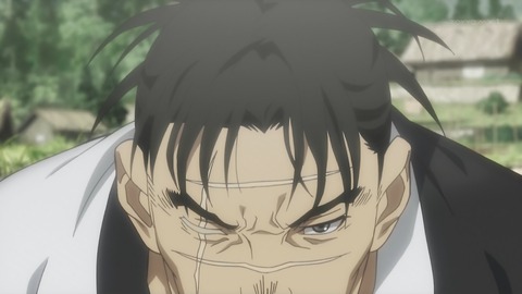 ancb00451